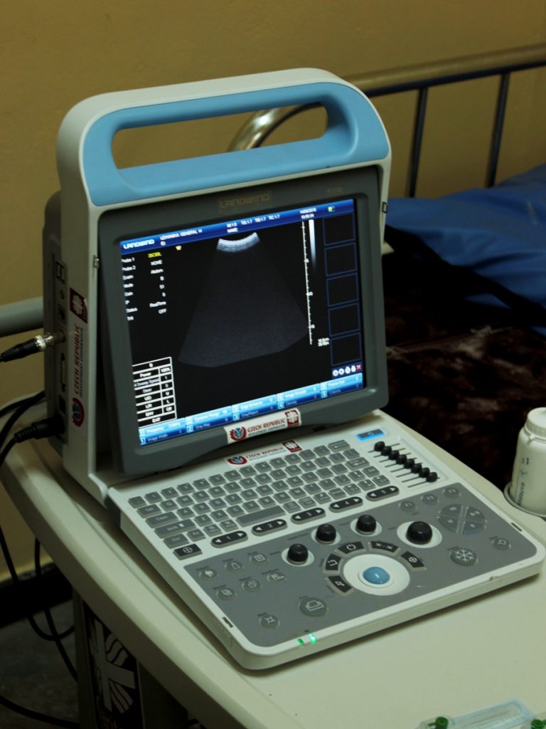 Nově pořízený mobilní ultrazvuk